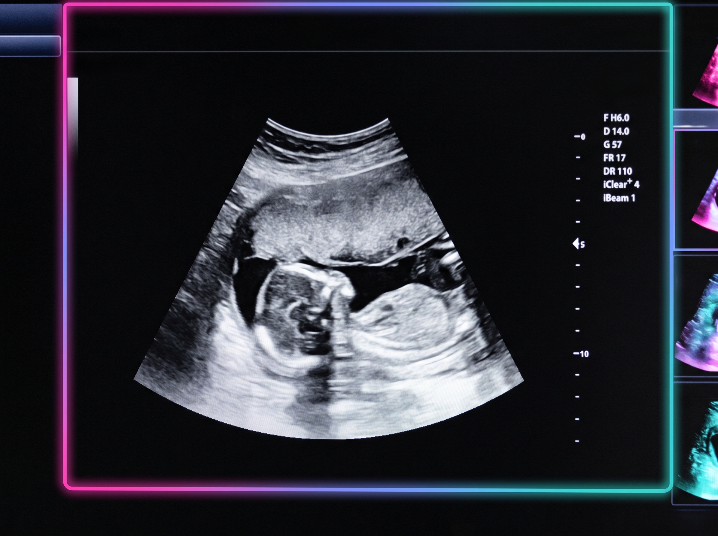 OBGYN-Fertility